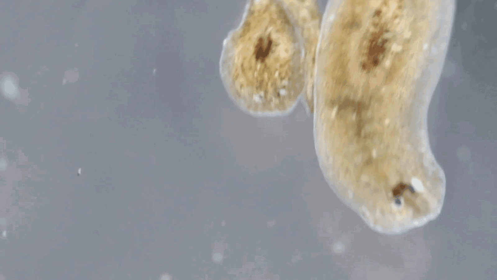 Parasites That Can Lead to Complications