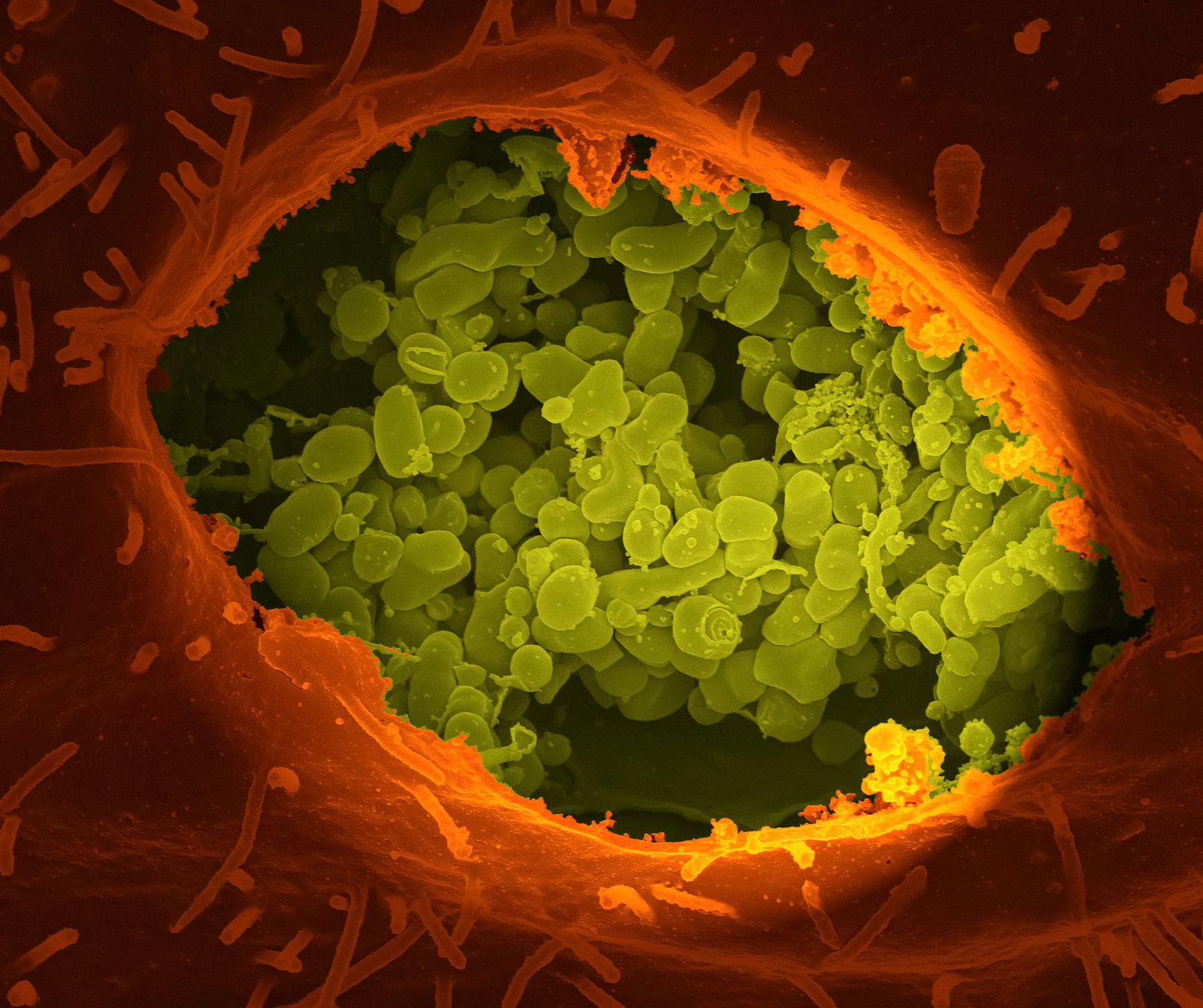 A Fresh Study Reveals the Protective Power of Silver on Human Cells